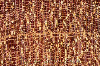 Histoxylographie : Manilkara bidentata (A. DC.) A. Chev. subsp. bidentata